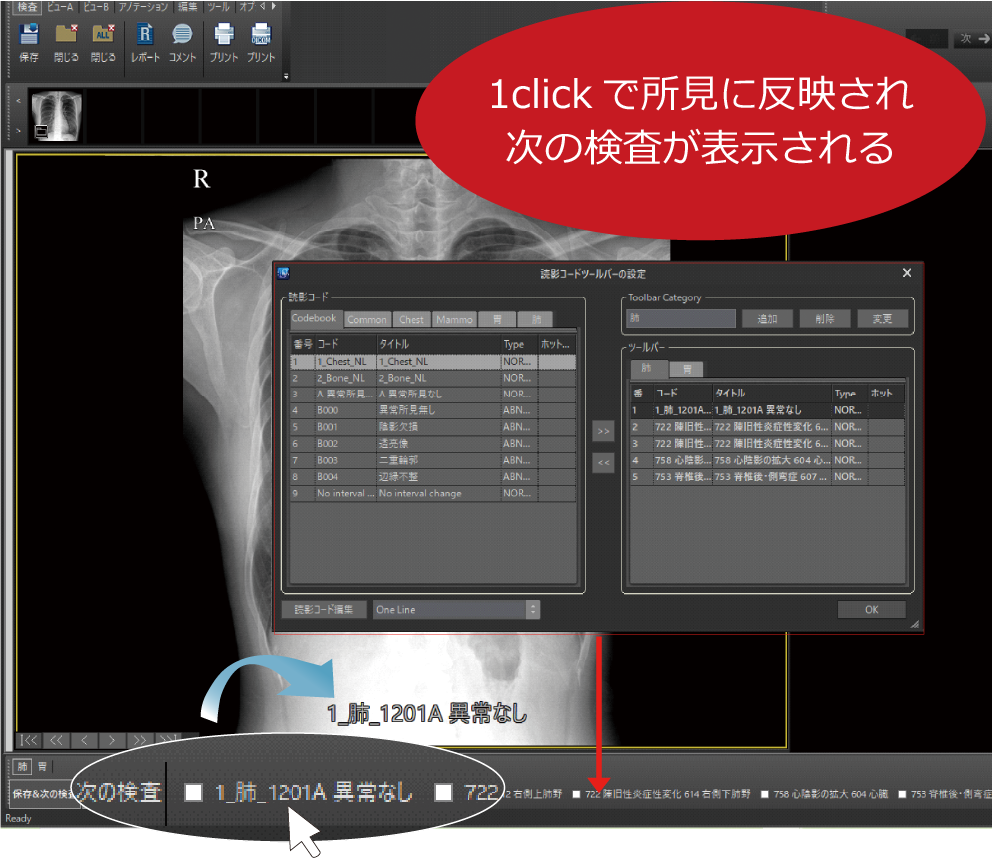 PACSPLUS SCREEN Viewer(Tele Version)/ ツールバー設定機能(読影コード追加登録)