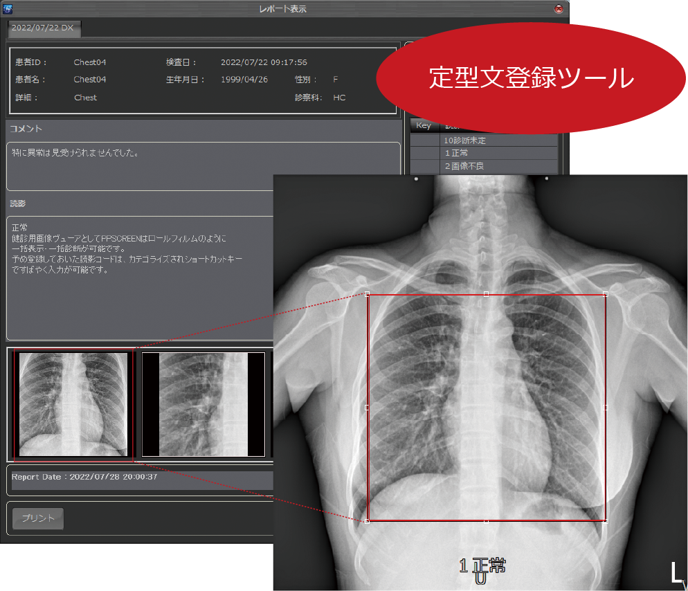 PACSPLUS SCREEN Viewer(Tele Version)/ 検査結果(レポート機能)