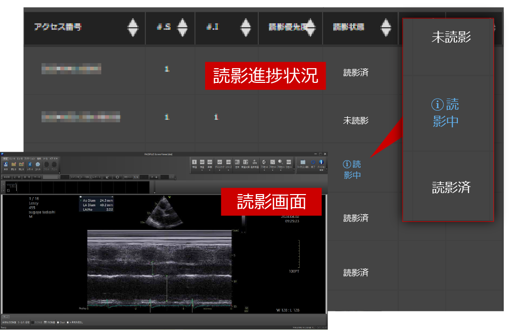 読影進捗がリアルタイム