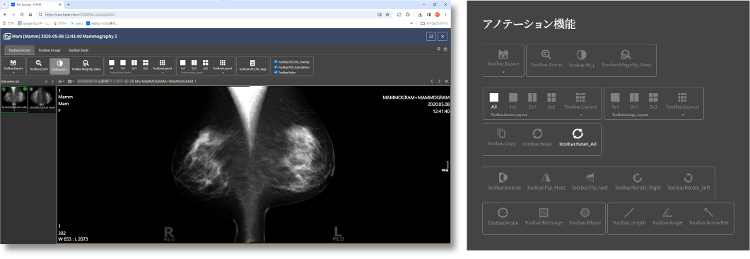 アノテーション機能搭載、共有された検査画像に保存可能